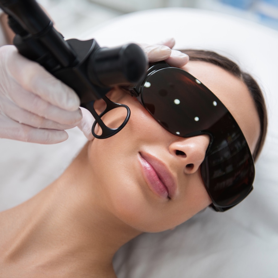 TRATAMIENTO LÁSER MANCHAS PIGMENTARIAS